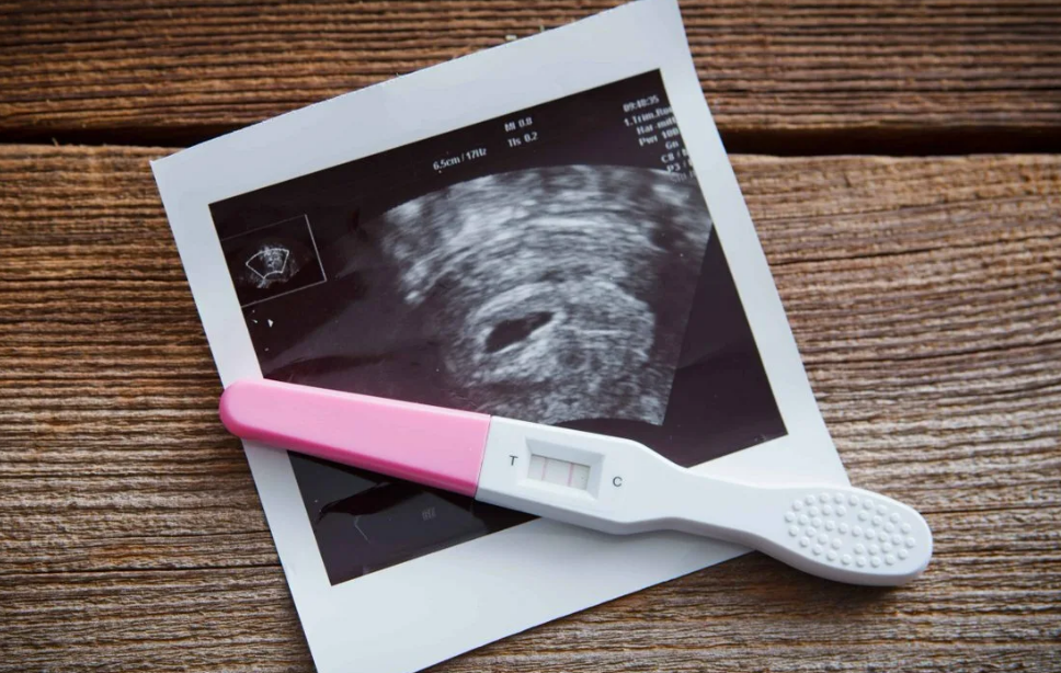 УЗИ при беременности – ультразвуковое обследование плода, позволяющее с помощью применения информативного метода диагностировать, как протекает беременность, есть ли отклонения от нормы.